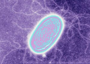 Diese Bakterien können von Elektronen leben. Bild: Derek Lovley/SPL